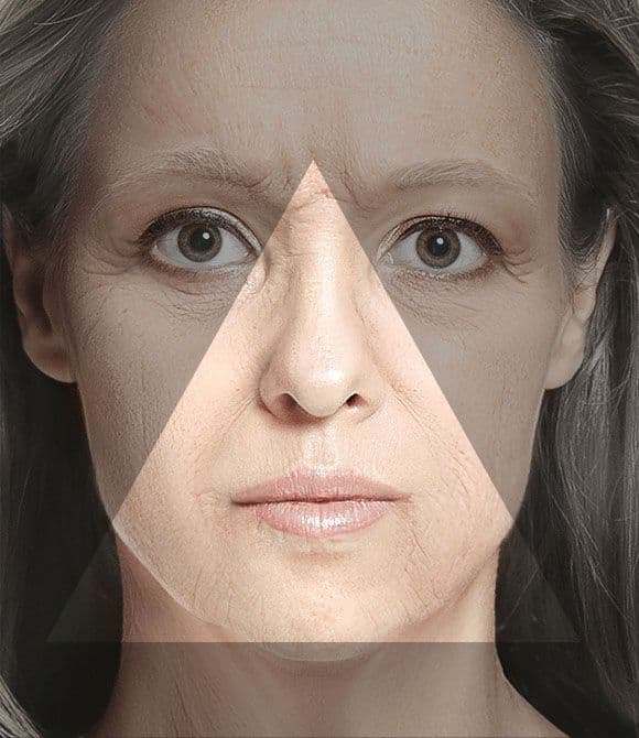Anatomy of an older face
