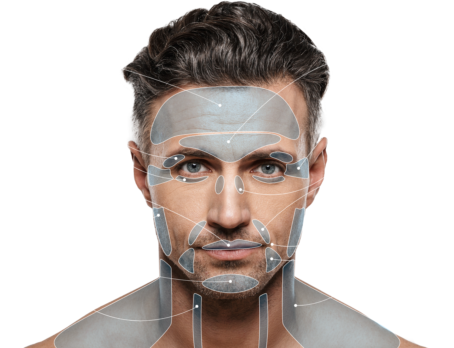 units of botox for men