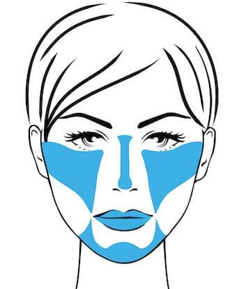 face map of treated areas for full face rejuvenation