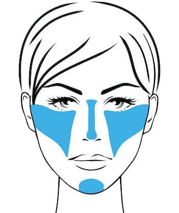 face map of treated areas for full face rejuvenation