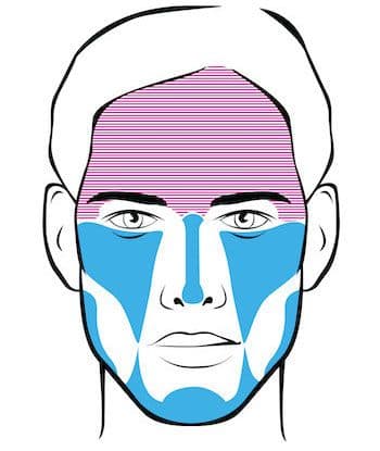 face map of treated areas for full face rejuvenation