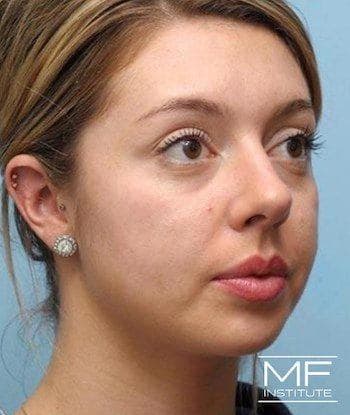 female before full face contouring