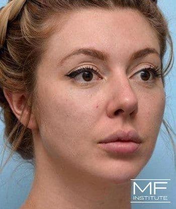 female before full face contouring