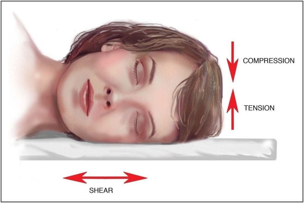 Does Sleeping On Your Side Cause Wrinkles? BOTOX® & JUVÉDERM® Fillers