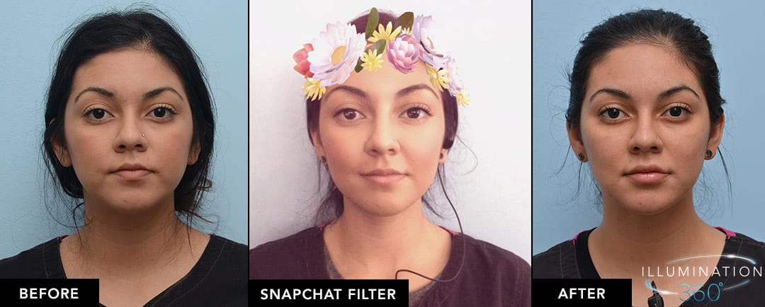 before, snapchat filter, after