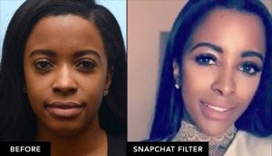 Jessica before and after snapchat filter