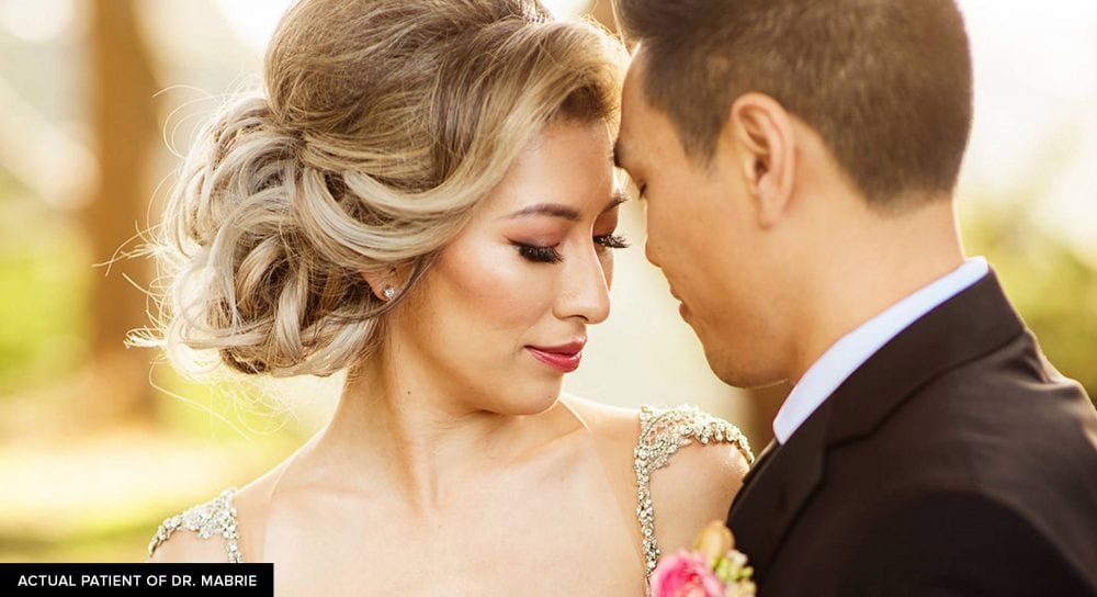 Candid wedding photo of patient who had the nonsurgical rhinoplasty procedure