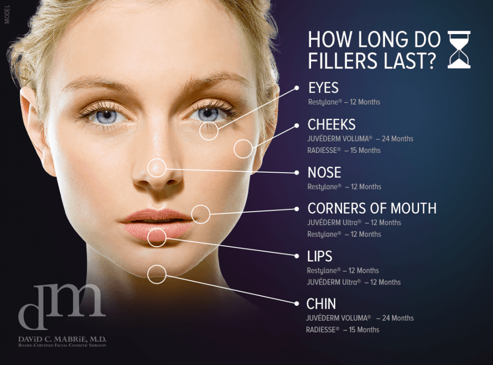 Lip Filler Chart