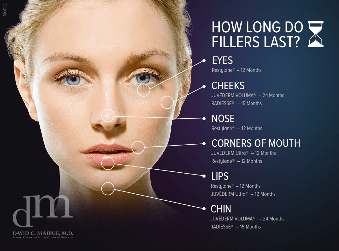 Longevity of Dermal Fillers Guide San Francisco Dr 