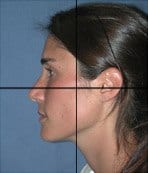Example of profile view