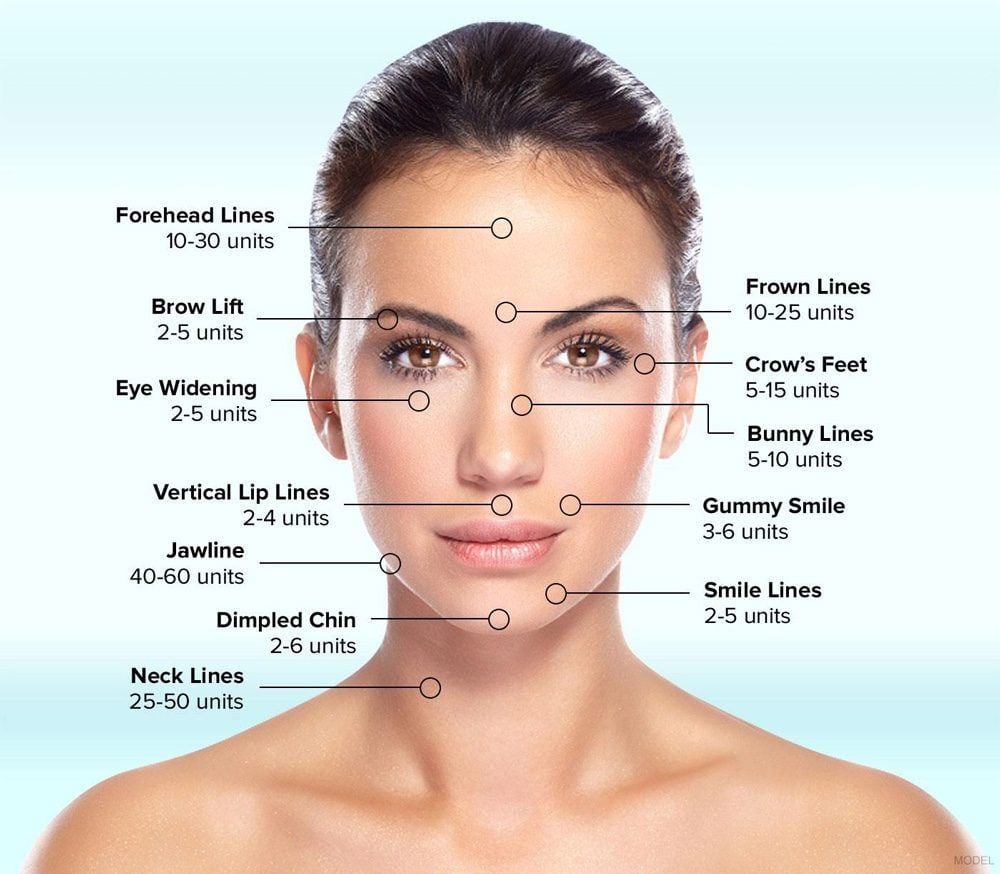 BOTOX® in the San Francisco Bay Area Dr. David C. Mabrie