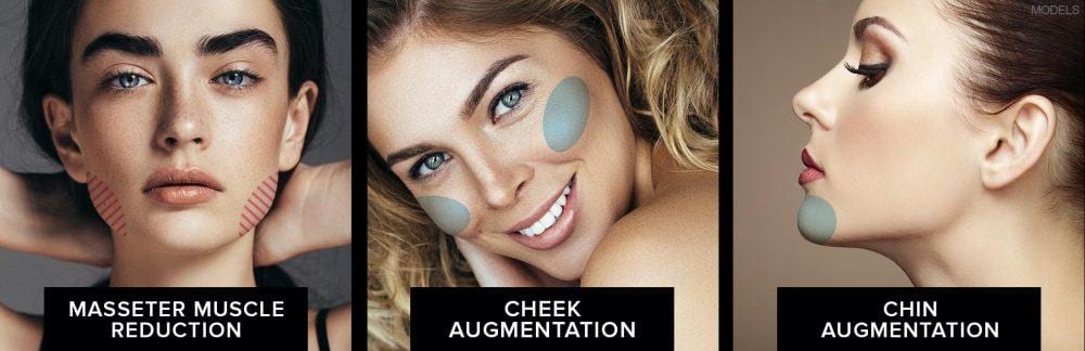 masseter muscle reduction, cheek augmentation, chin augmentation,