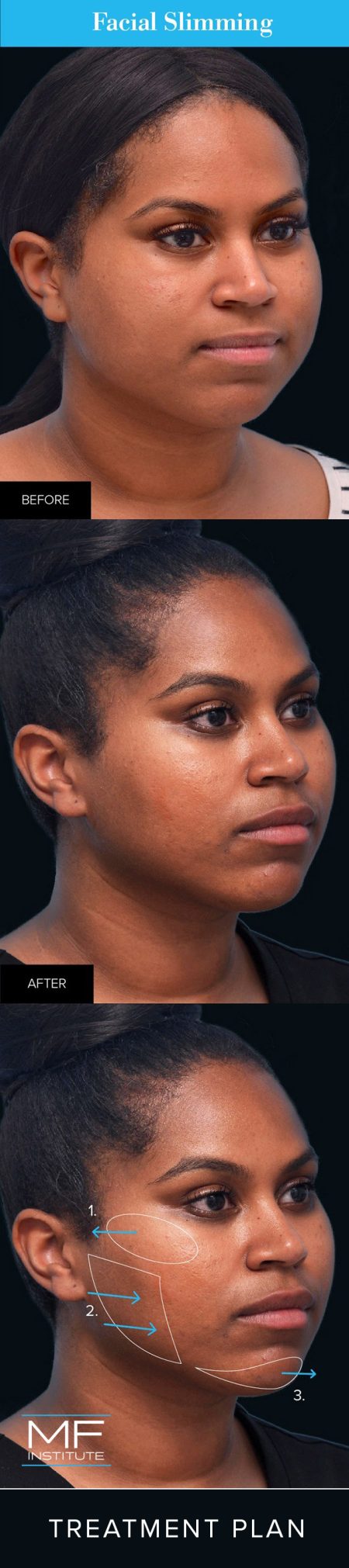 How to get smaller face shape best sale