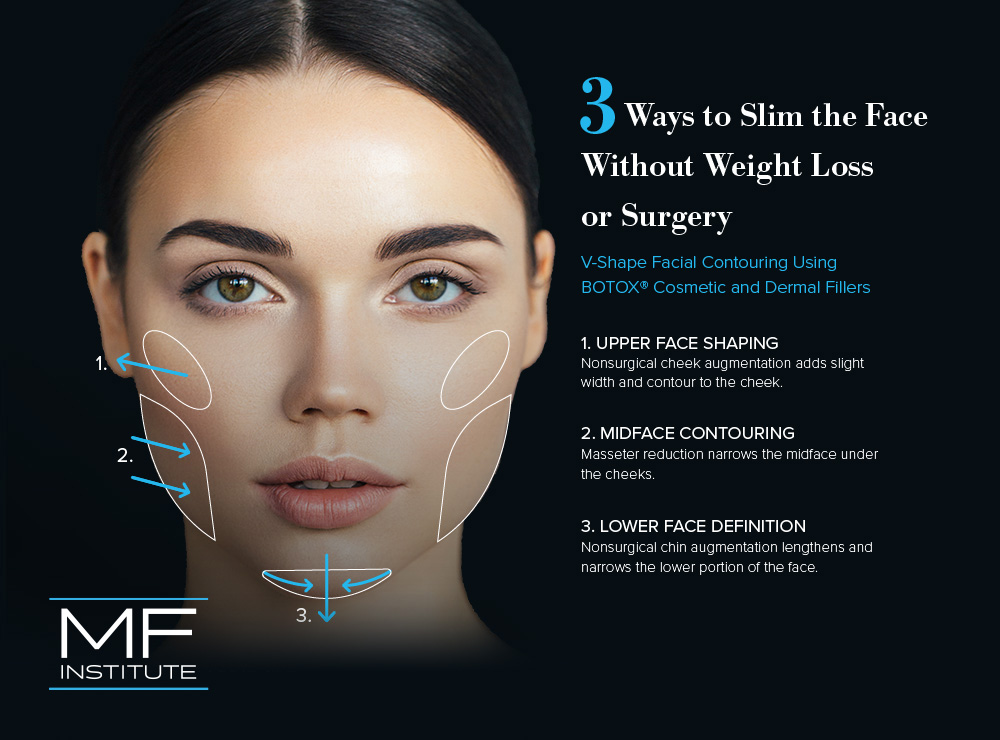 Forget Buccal Fat Removal: Start With BOTOX® for Face Slimming (Updated  2023) – Mabrie Facial Institute