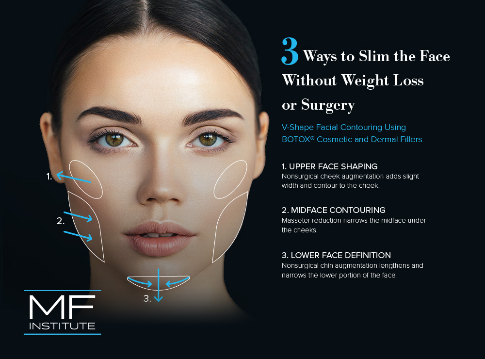 Forget Buccal Fat Removal: Start With BOTOX® for Face Slimming