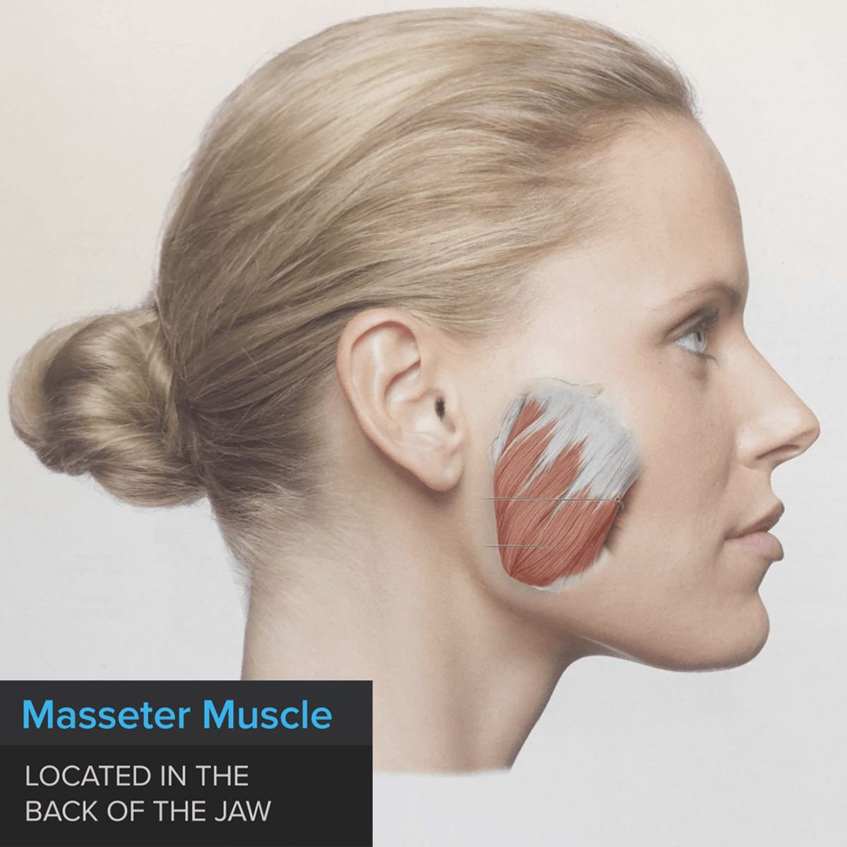 Masseter muscle located in the back of the jaw.