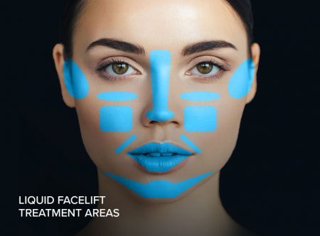 liquid facelift treatment areas