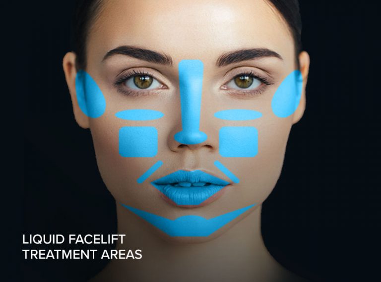Facelift vs. Non Surgical (Liquid) Facelift in the San Francisco Bay Area