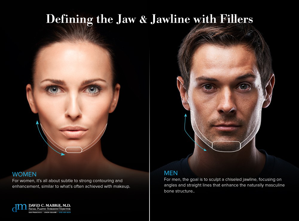 Jawline Filler for Definition & Contour (Updated 2023) – Mabrie Facial  Institute