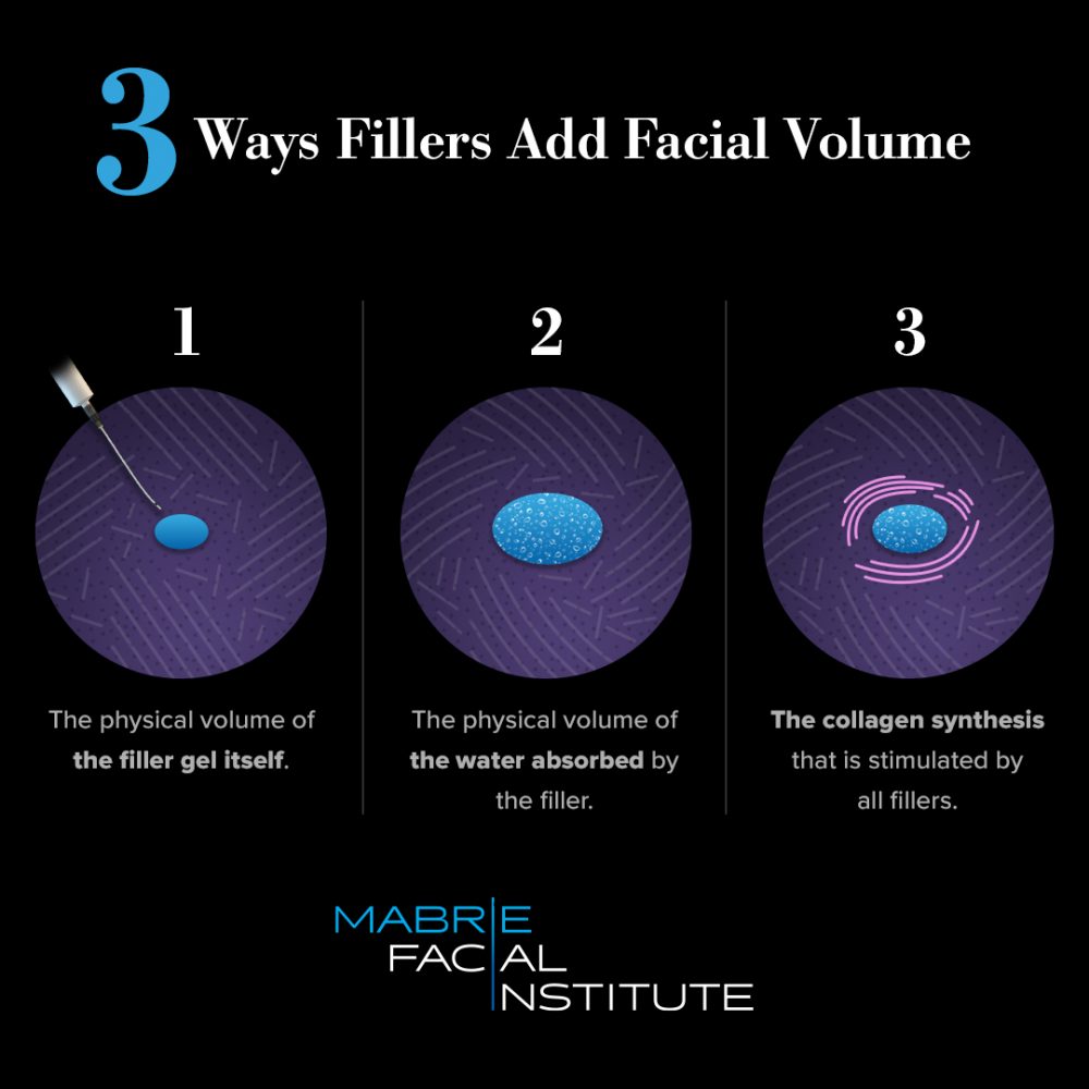 3 Ways Fillers Add Facial Volume