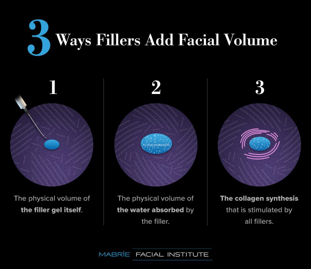 Infographic: 3 Ways Fillers Add Facial Volume