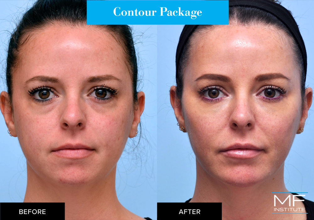 Contouring package before and after