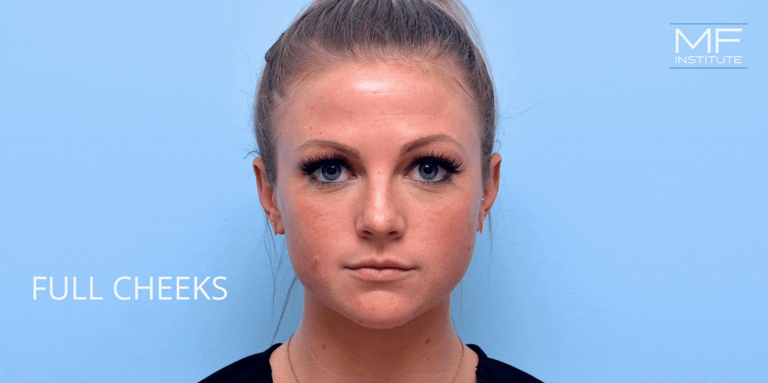 The feature of a babyface