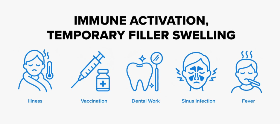 Icons for viral illness, vaccination, dental work, sinus infection, and fever, linked to temporary immune-related filler swelling.