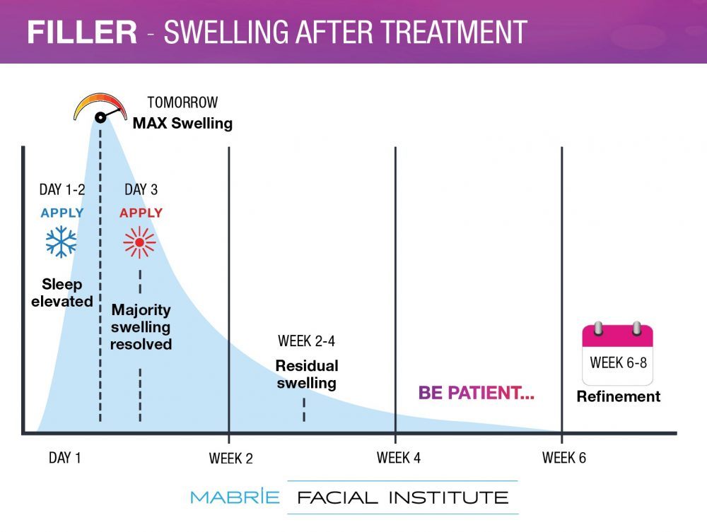 a graphic depicting filler-related swelling over time