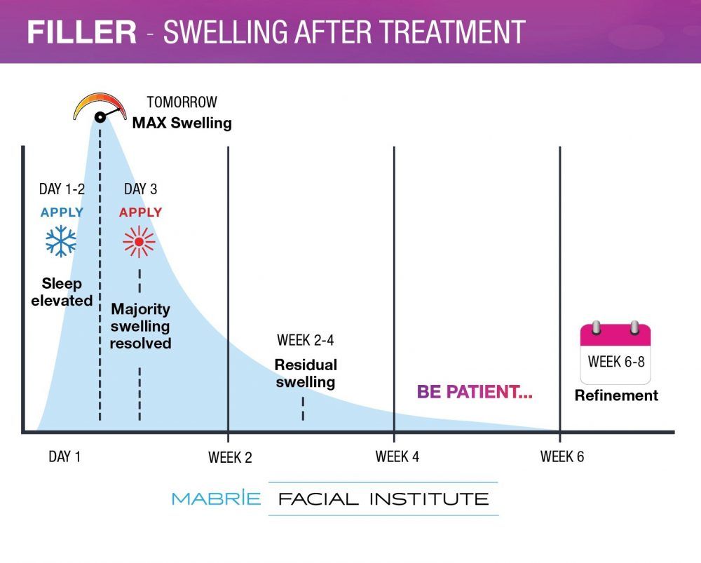 Graphic outlining filler swelling after treatment