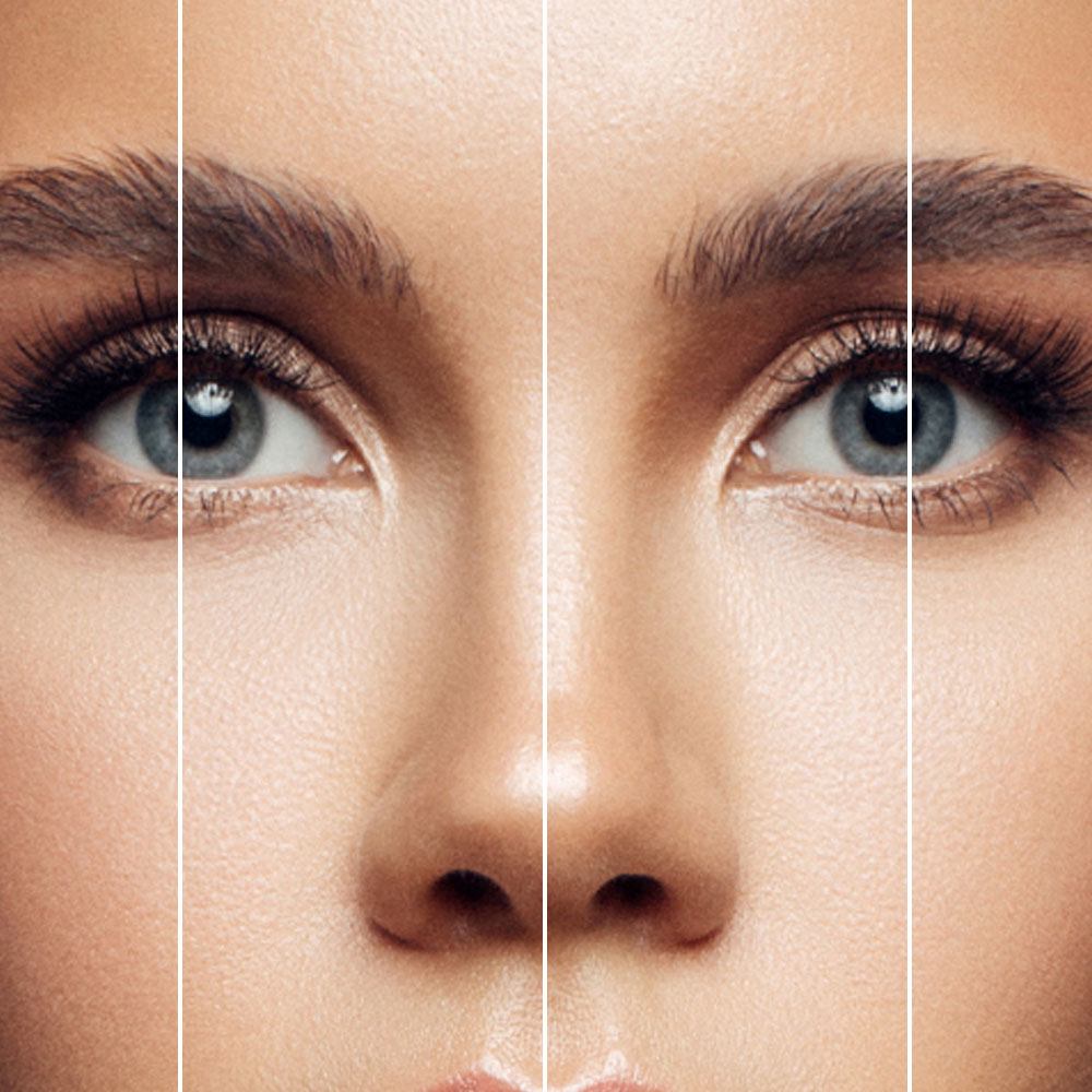Symmetry in the face to achieve a beautiful result with dermal fillers in San Francisco