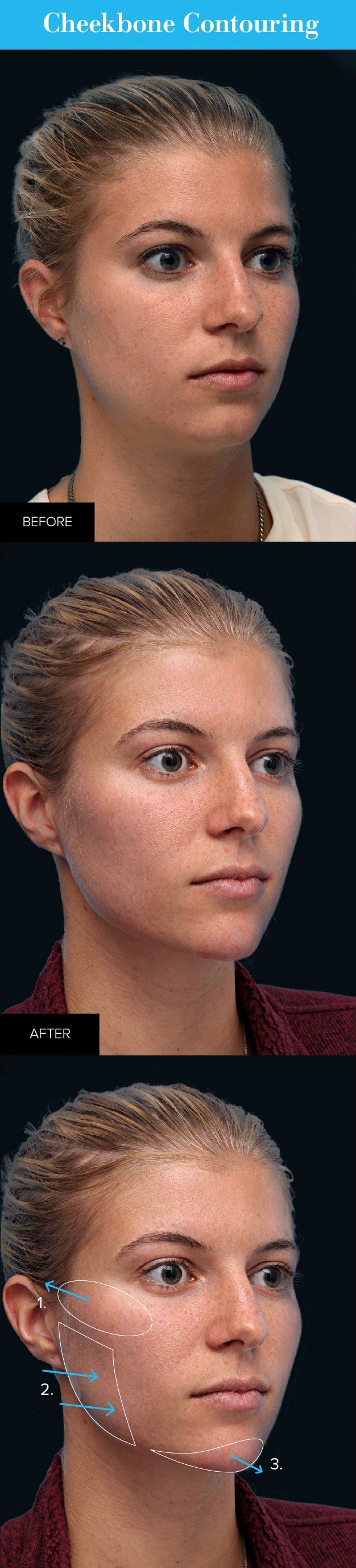 before and after infographic of cheekbone contouring