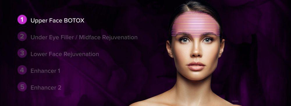 Upper Face BOTOX