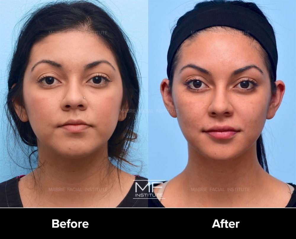 Woman actual face before and after