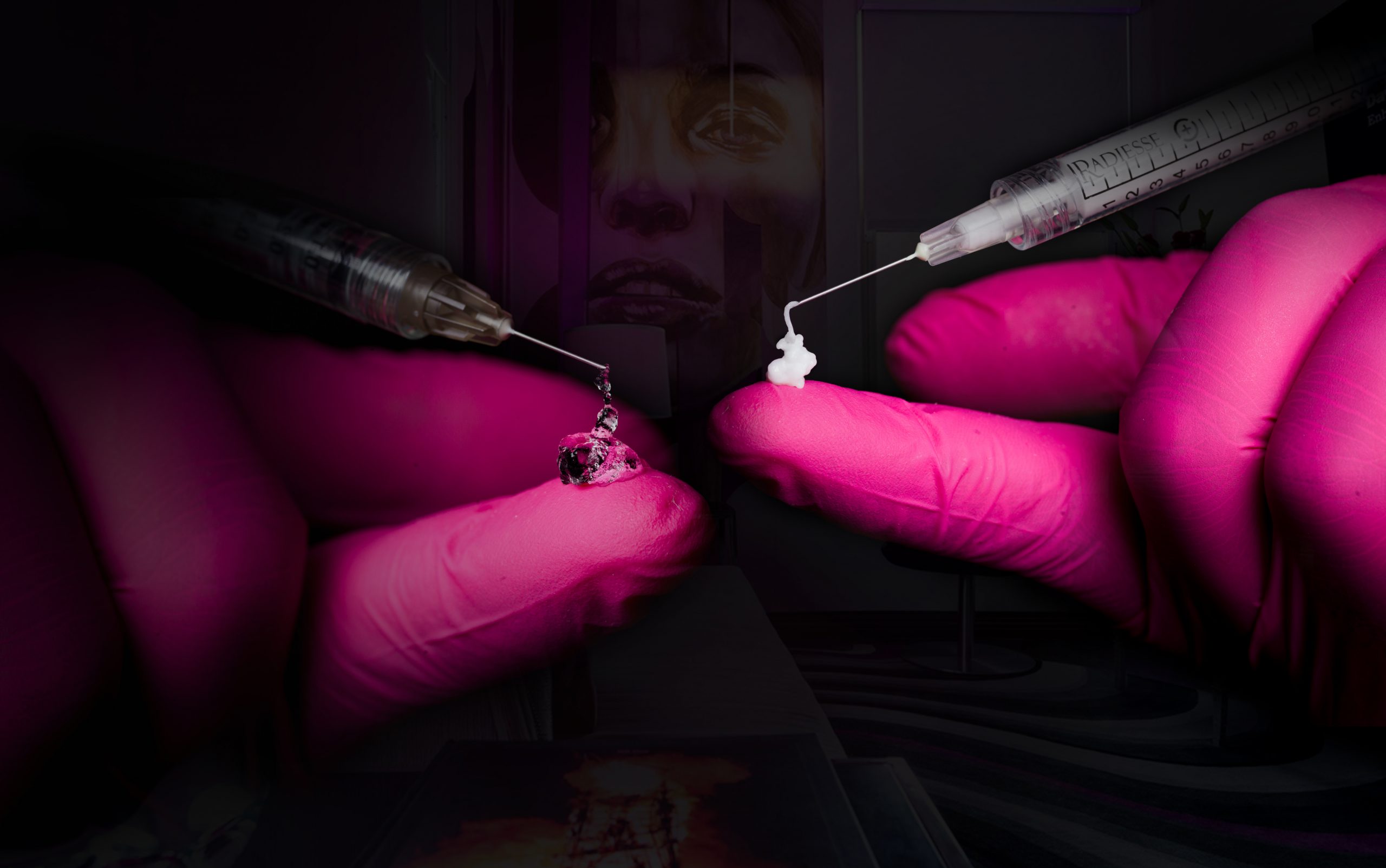 botox and dermal fillers being injected onto a pink glove to show the consistency