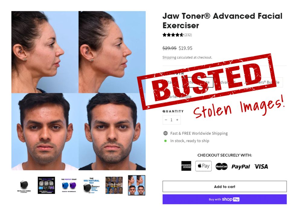 MFI before and after pictures being used without permission on the Jaw Toner website