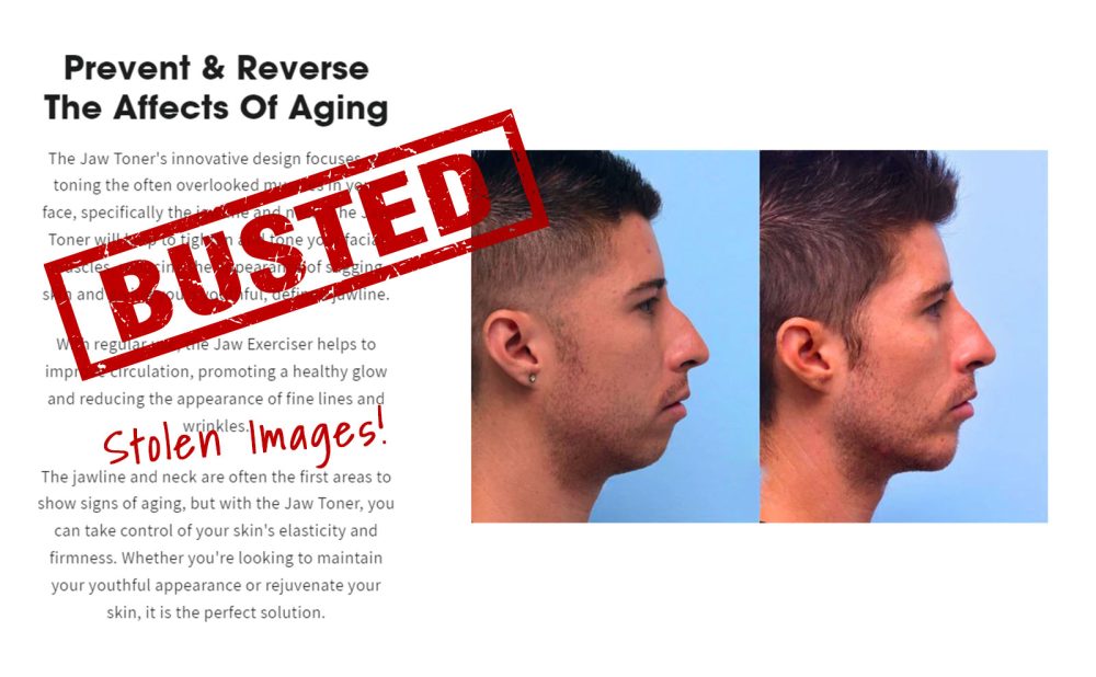 MFI before and after images being used on the Jaw Toner website without permission