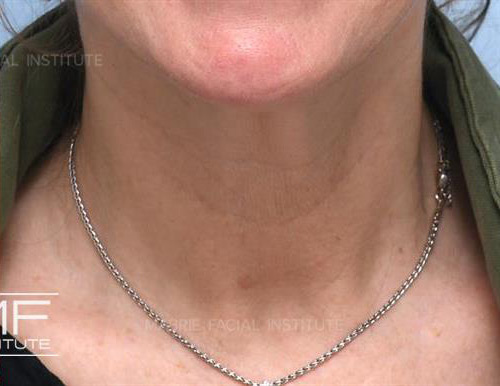 After Image