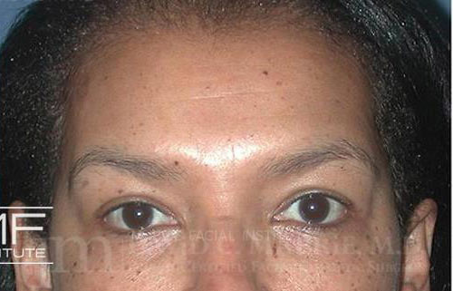 After Image