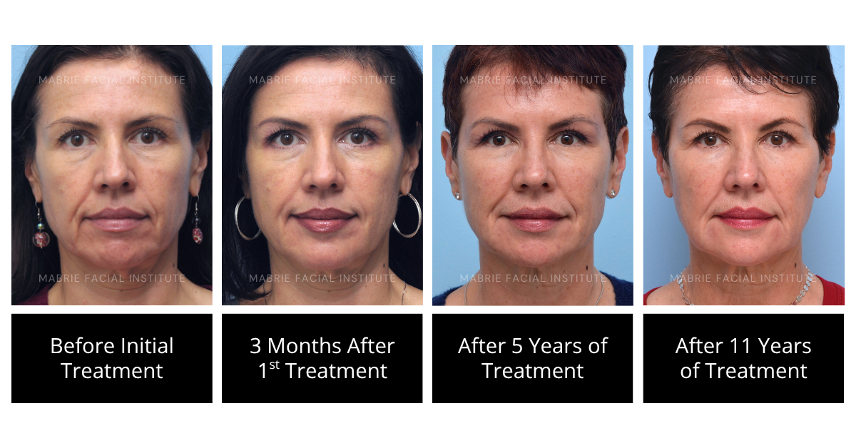 Fafi Method Precision in Every Pixel: MFI’s Proven Photo Protocol for Long-Term ...