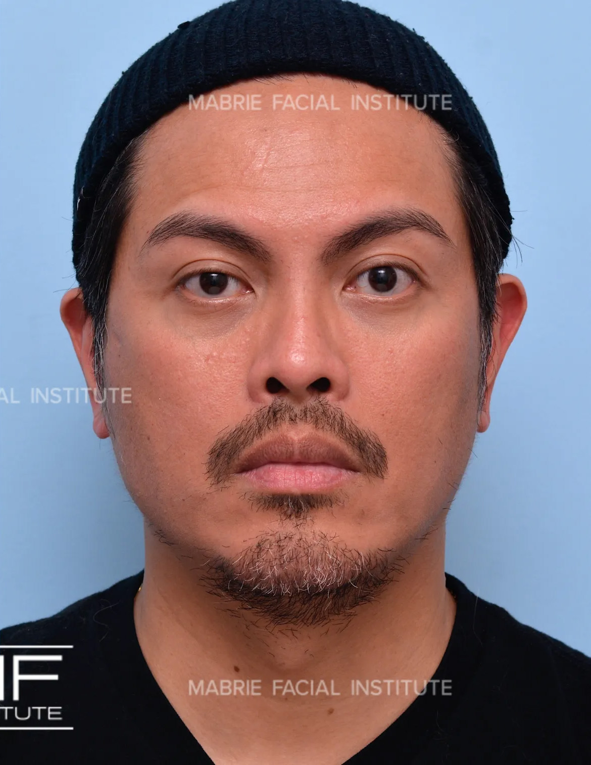 After Image