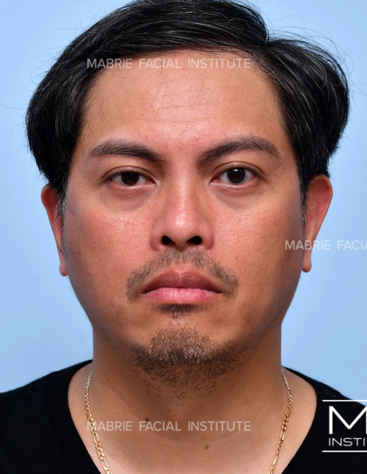 Before Image