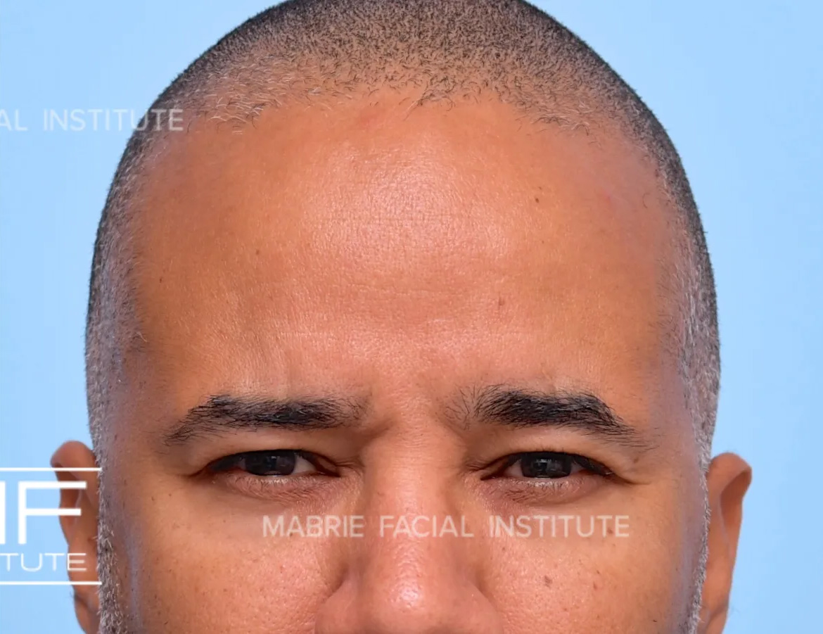 After Image