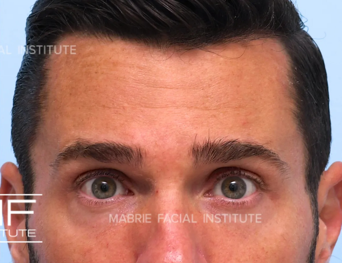 After Image