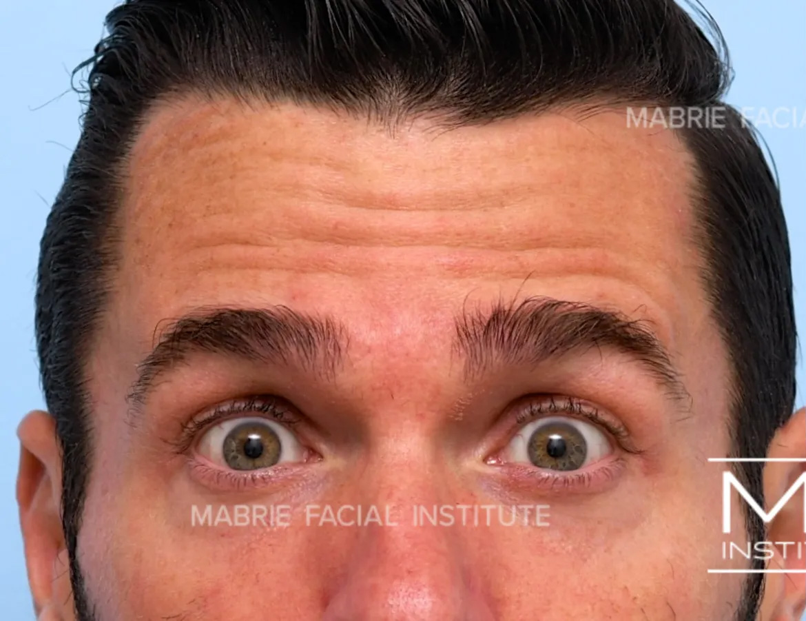 Before Image