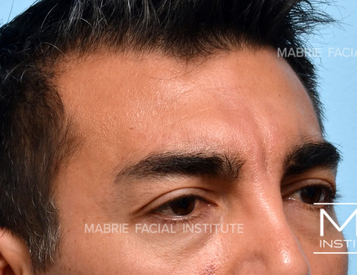 Before Image
