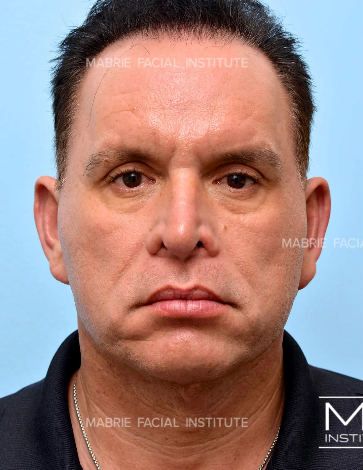 Before Image