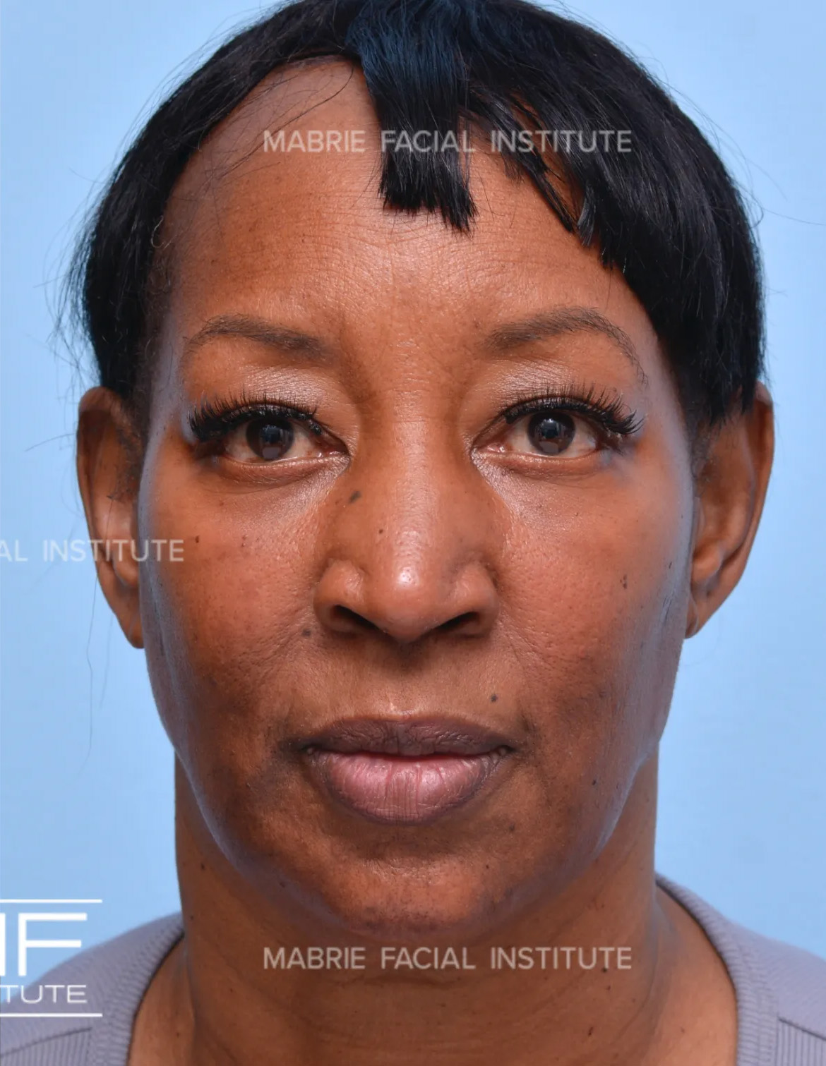 After Image