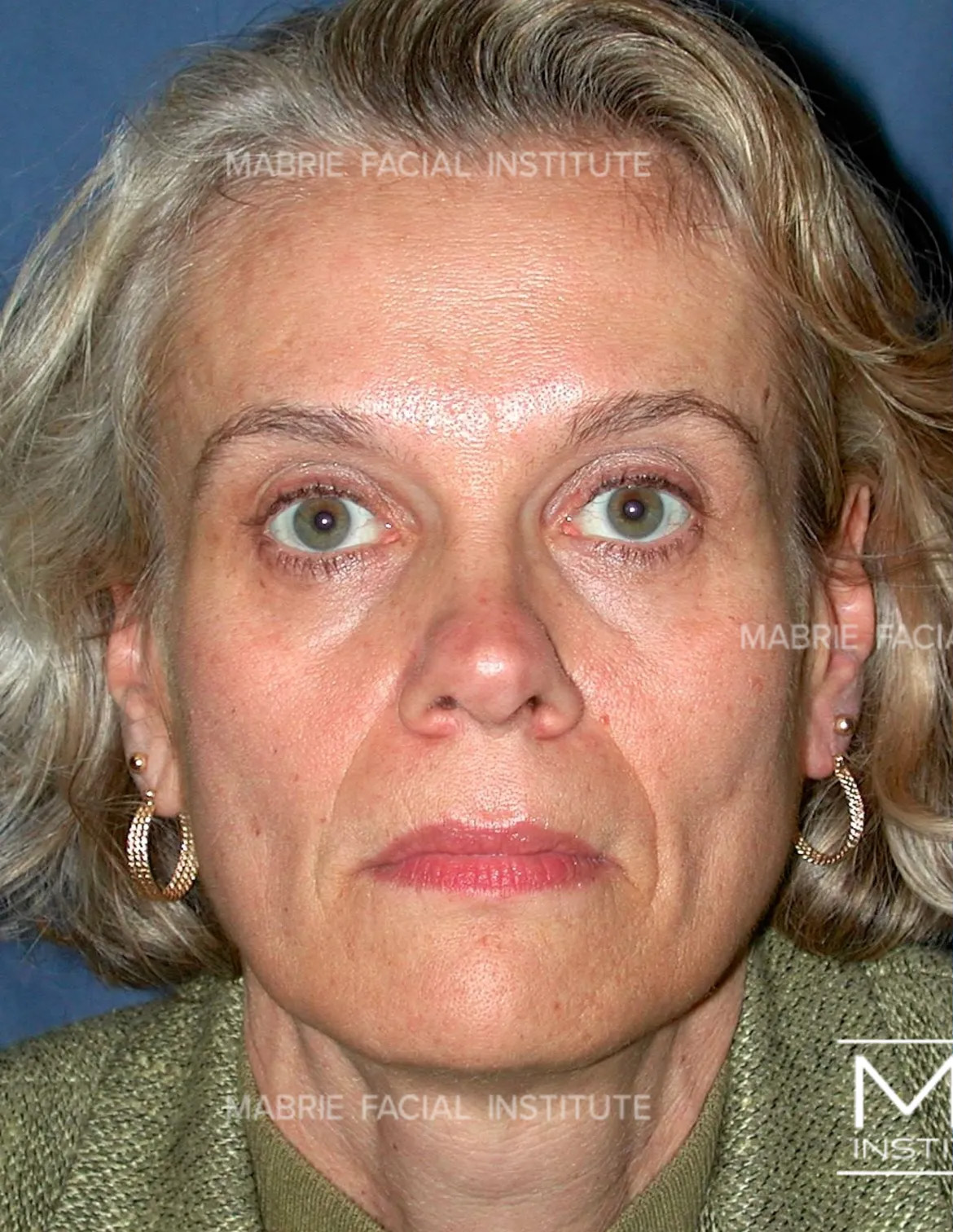 Before Image