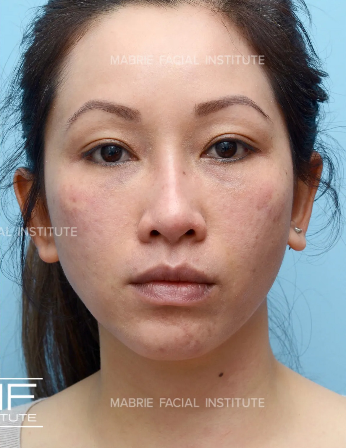 After Image